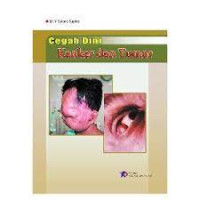 Image of Cegah Dini Tumor Dan Kanker